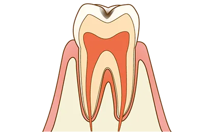 C1